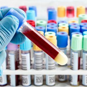 blood test with vitamin